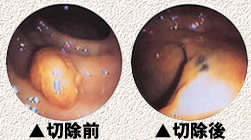 �ڽ������ڽ���